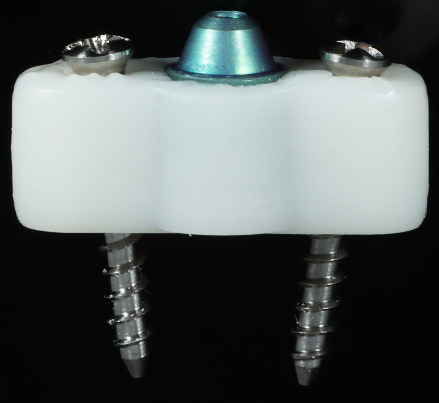 BTR (BONE TIGHT REFERENCE)-Maxillary or Mandibular