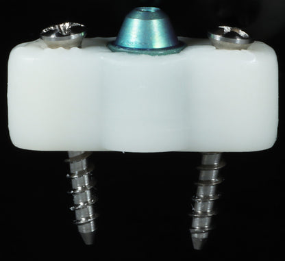 BTR (BONE TIGHT REFERENCE)-Maxillary or Mandibular